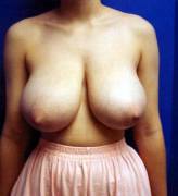 [Image] huge tits