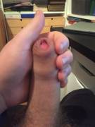 Foreskin for you :)