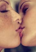 Freckled kisser