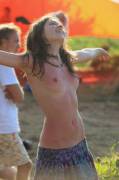 12-pics of topless girl with a sunburn at a music festival