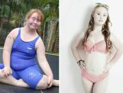 Girl with Down Syndrome loses weight to become model.