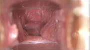 Insides of a vagina slowly closing up