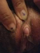 Daddy gets my clit all [F]at and swollen.