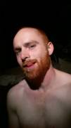 Ginger Facial (X-Post /r/gaygingers)