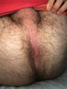 My hairy ass...what do you guys think?