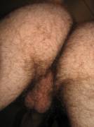 Hairy all over