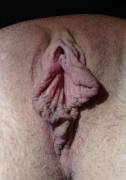 not sure about my labia... what do you think?