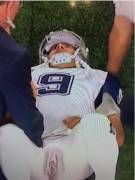 Leaked X-Ray of Tony Romo's injury