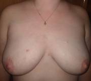 F31, 5'2", (not sure of weight) Here's my boobs how they normally lay.