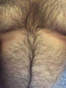 I love this picture of my body hair. What do you think?