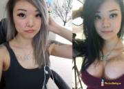 Asian girl buys new boobs!:)