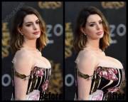 Anne Hathaway Infected with the Bimbo Virus