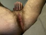 Showing that hairy taint and hole