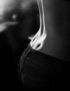 Defined back dimples