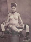 Prostitute with 4 boobs 2 vaginas and 3 legs. Her name was Blanche Dumas. NSFW [X-Post from WTF]