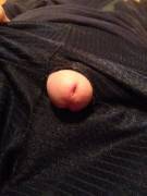 Hole in my shorts