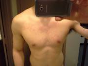 DAE get splotches on their chest/neck when ham slamming/biscuit buttering? Shirtless guy pic btw.