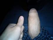 Thumb Vs Softie
