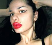 100 Lip Injections to Look Like Jessica Rabbit